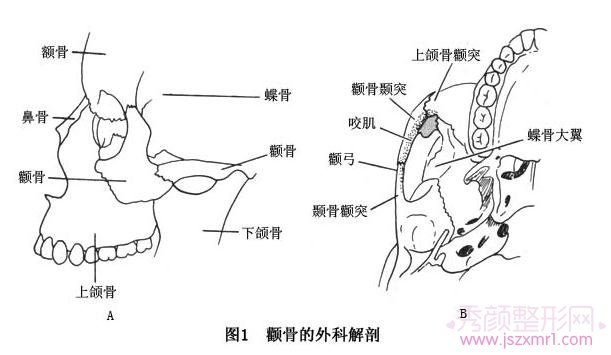 上海磨颧骨哪家医院做的好?