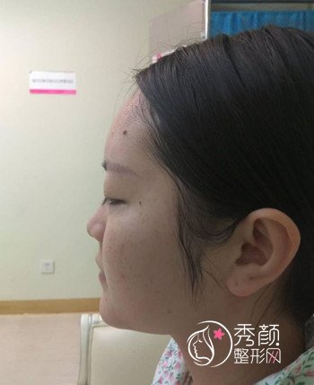 上海艺星做鼻部手术怎么样,我来分享一下。