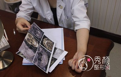 南京医科大友谊整形下颌角整形案例分享。