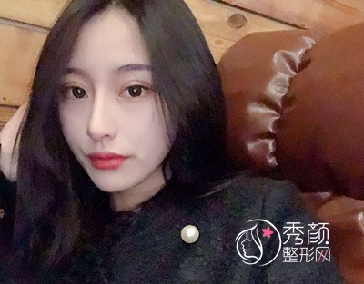 河南中医药大学第一附属医院赵绛波磨骨案例。