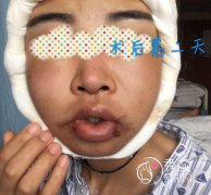 北大人民医院彭喆磨骨改 北大人民医院彭喆磨骨改