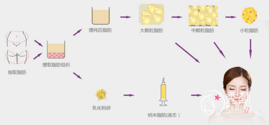 南京华美脂肪填充怎么样|哪个医生好|案例曝光