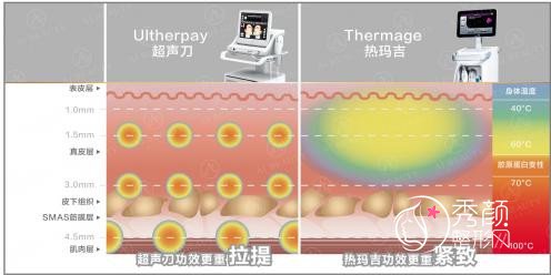 上海九院热玛吉和超声提拉调节哪个果会更好呢