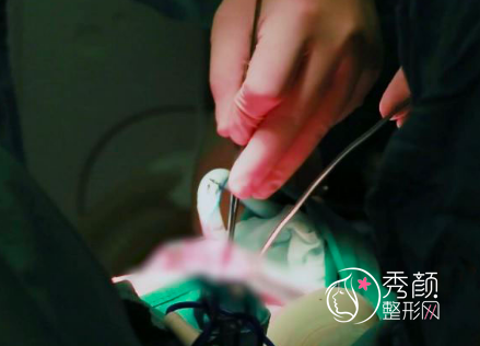 北京八大处唇腭裂修复手术多少钱？哪个医生技术好推荐！