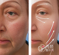 国内做smas面部提升术好的 国内做smas面部提升术好的