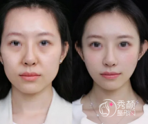 北京面部注射填充医生排 北京面部注射填充医生排