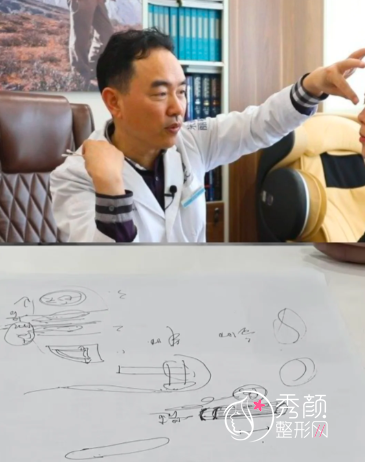北京隆鼻面诊记录:刘彦军、龙飞、巫文云等北京知名靠谱隆鼻医生