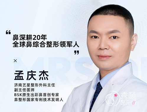 济南艺星孟庆杰隆鼻怎么样,有没有失败案例?附隆鼻案例展示