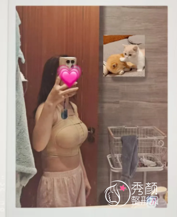 产后假体隆胸多少钱,北上广单侧假体隆胸1.5万元起