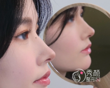 深圳隆鼻厉害的医生排名 深圳隆鼻厉害的医生排名