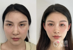 天津轮廓固定医院哪家好 天津轮廓固定医院哪家好