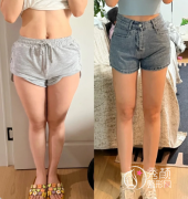 温州吸脂医院排名:市人 温州吸脂医院排名:市人