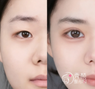 徐州出名的眼部整形医院 徐州出名的眼部整形医院