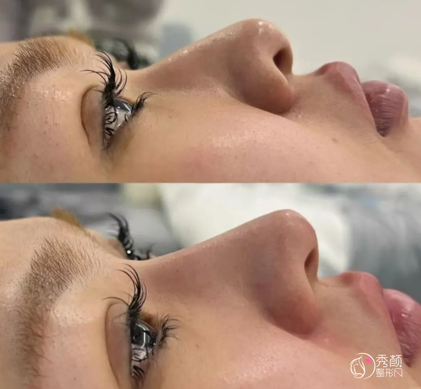 武汉隆鼻医生排名:钟爱梅、徐逸、葛海辉等医生实力上榜