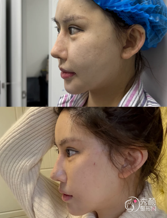 济南拉皮医生排名:肖虎、张基勋、王法刚等医生实力上榜