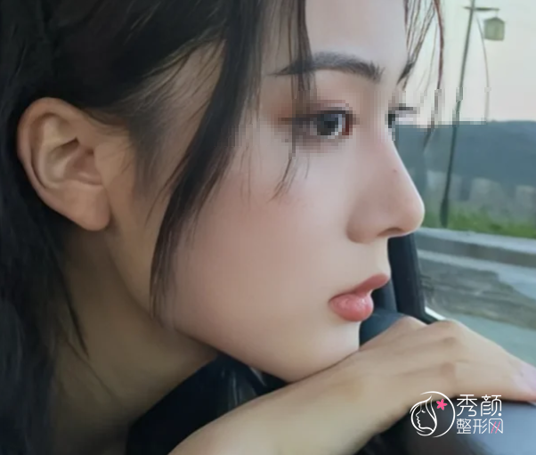 上海爱贝芙认证医生排名:聂婕、杨春梅、董明辉等医生实力上榜