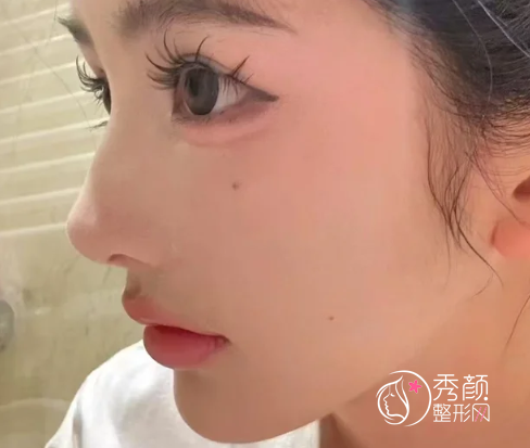 成都爱贝芙认证医生排名:谢雯、黄剑美、徐柯俊等医生实力上榜