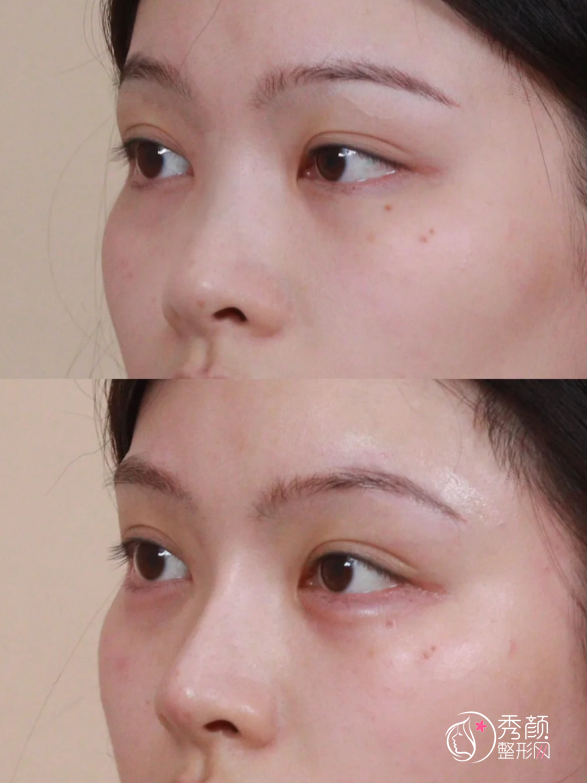 青岛爱贝芙认证医生排名:阮潇舒、高玉洁、姜哲等医生实力上榜