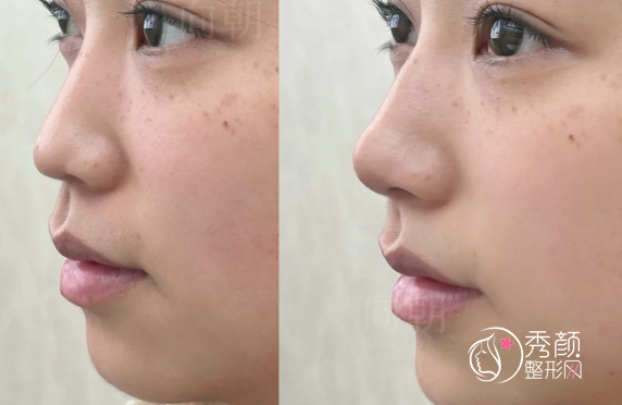 济南宝尼达认证医生排名:李玉茹、刘近兰、于杰等医生实力上榜