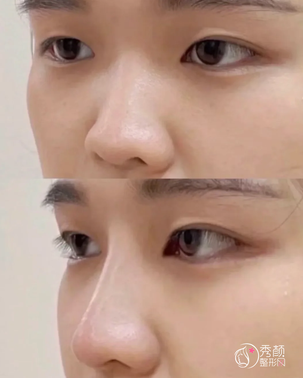 青岛宝尼达认证医生排名:盛纯晶、孙鑫、陈芙莉等医生实力上榜