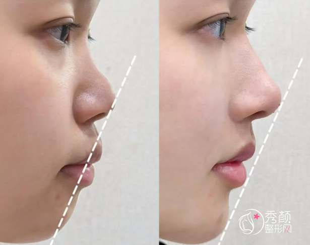 北京宝尼达认证医生排名:谷亦涵、曾艳、韩楚等医生实力上榜