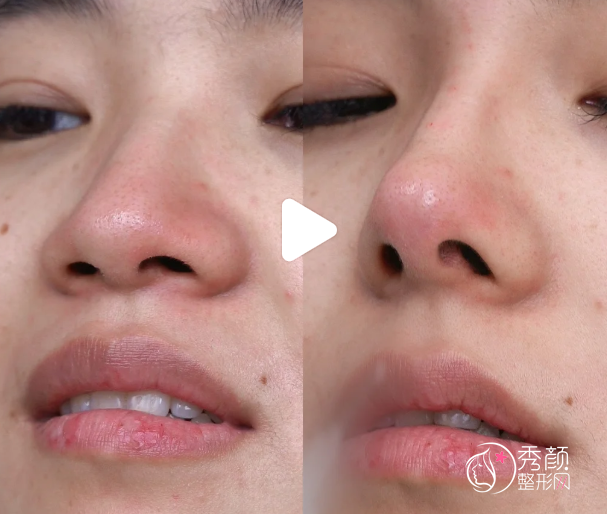 上海宝尼达认证医生排名:申涛、胡丽萍、郭敬松等医生实力上榜