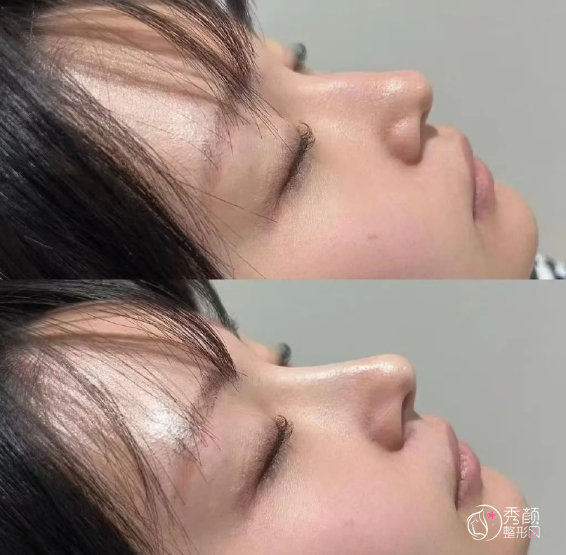 重庆爱贝芙认证医生排名:李富强、田鹏飞、牙祖蒙等医生上榜