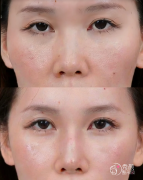 深圳鼻综合医生排名:李 深圳鼻综合医生排名:李