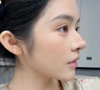 重庆鼻综合医生排名:刘 重庆鼻综合医生排名:刘