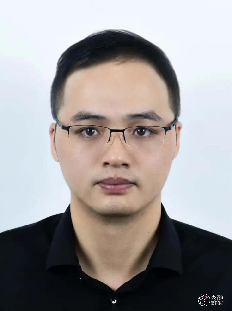 温志刚割双眼皮怎么样?内含坐诊机构&双眼皮案例