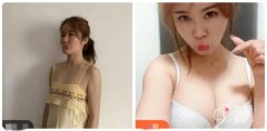 南昌二附院丰胸怎么样? 南昌二附院丰胸怎么样?