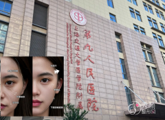 上海九院玻尿酸填充怎么 上海九院玻尿酸填充怎么