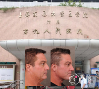 上海九院拉皮手术做得怎 上海九院拉皮手术做得怎