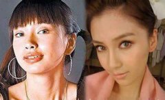 整过形的明星有哪些