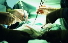 什么是缩阴手术