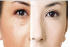 哪种整容美白的方法好