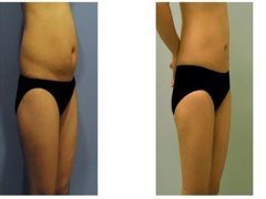 减肚子的较快方法