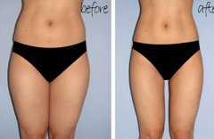 如何减掉小肚腩