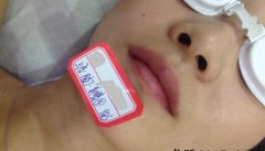 女生长胡子怎么办