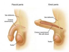 延长阴茎的方法