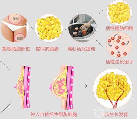 丰胸秘籍有哪些