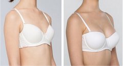 产后丰胸有什么好的方法