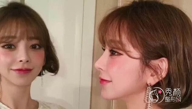 北京韩啸整形12月整形价格福利大派送