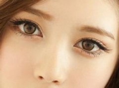 <b>开眼角会留疤吗？</b>