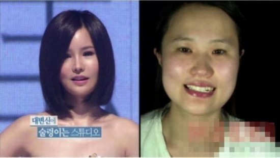 丑女大变样 韩国惊人整容又爆新案例（图片）