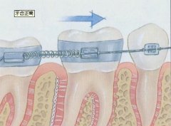 <b>牙齿正畸/牙齿矫正</b>