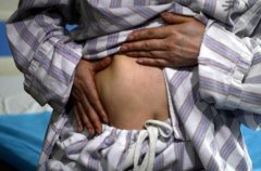 现实版《整容日记》女子隆胸奥美定材料满身跑