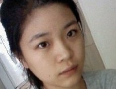 隆鼻+开眼角+韩式微切双眼皮，让我距离更近