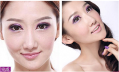 <b>美白多久打一次较好?</b>