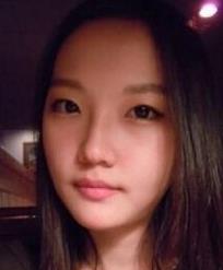 点击进入连续看图模式 方下巴手术和面部轮廓术看看我手术前后的模样
